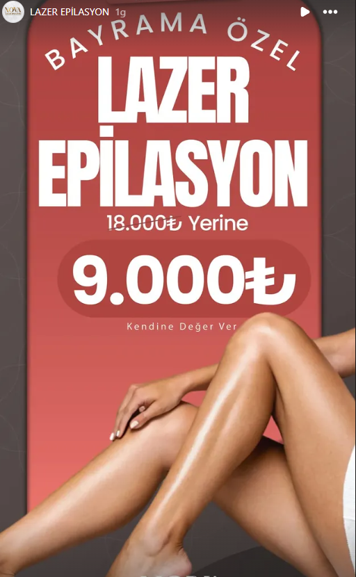 Lazer Epilasyon | Kütahya
